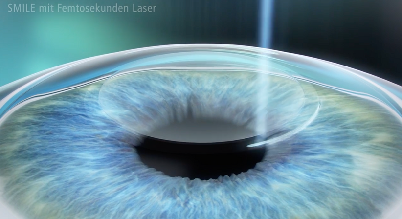 Relex SMILE - Prof. Dr. Dr.  Nikolaus Luft, FEBO, FWCRS - Augenarzt Linz 4020