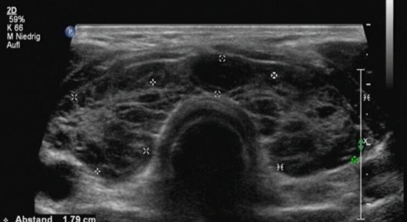 Abdomen-Sonography und  Schilddrüsen-Sonographie  - OA Dr. med. univ. Ahmed Zidan - Kardiologe Wien 1030