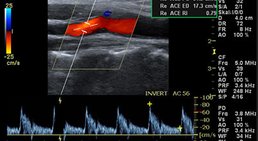 OA Dr. med. univ. Ahmed Zidan - Kardiologe Wien 1030