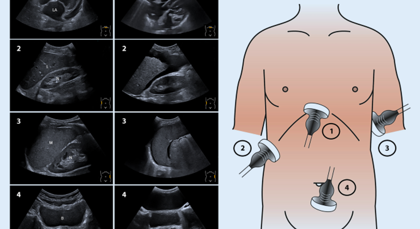 Abdomen-Sonography und  Schilddrüsen-Sonographie  - OA Dr. med. univ. Ahmed Zidan - Kardiologe Wien 1030