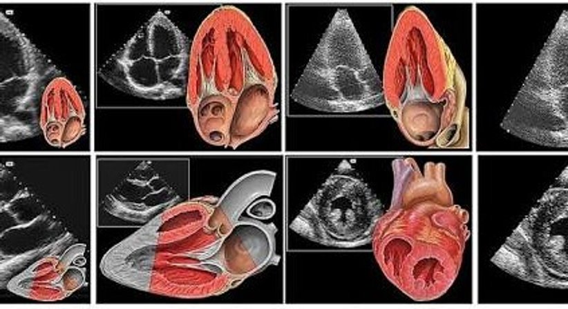 Echokardiographie - OA Dr. med. univ. Ahmed Zidan - Kardiologe Wien 1030
