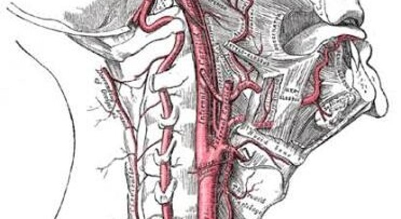 Carotis-Duplex - OA Dr. med. univ. Ahmed Zidan - Kardiologe Wien 1030