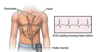 Ruhe EKG, LZ-EKG und 24 Stunden Blutdruckmessung