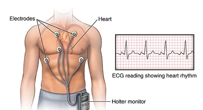 Ruhe EKG, LZ-EKG und 24 Stunden Blutdruckmessung - OA Dr. med. univ. Ahmed Zidan - Kardiologe Wien 1030