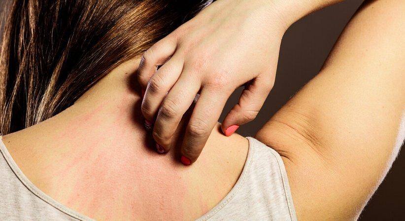 Allgemeine Dermatologie - Dr. med. univ. Mo Pachala - Hautarzt Wien 1220