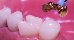 DDr. Vera Masic-Cabak - Zahnärztin Wien 1180