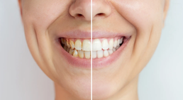 DDr. Robert Mallinger - Zahnarzt Wien 1150