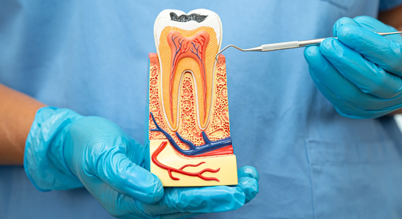 Wurzelkanalbehandlungen (Endodontie) - DDr. Robert Mallinger - Zahnarzt Wien 1150