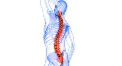 Röntgengezielte Infiltrationen der Wirbelsäule