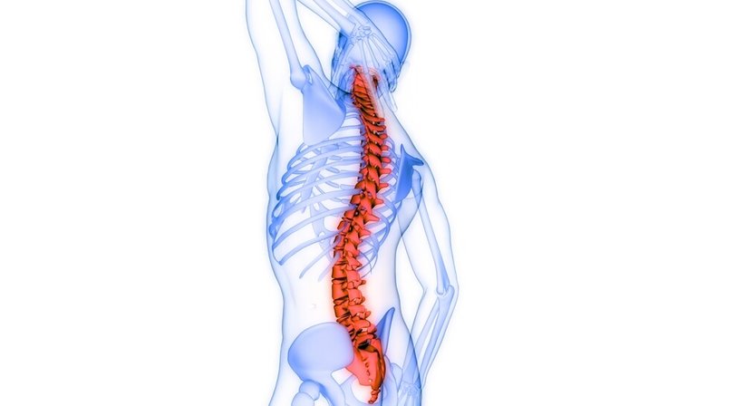Röntgengezielte Infiltrationen der Wirbelsäule - Dr. Greta Lorenz, BSc (WU) - Orthopädin Wien 1170