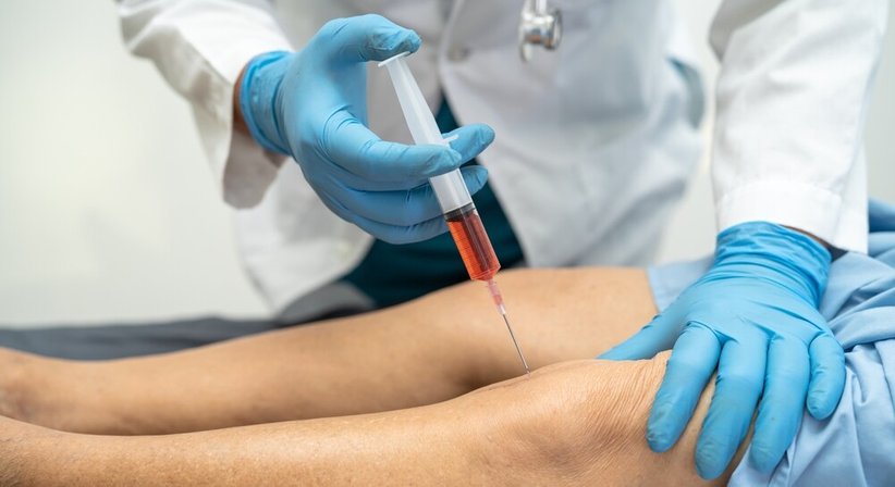 Hyaluronsäuretherapie („Knorpelaufbaukur“) - Dr. Greta Lorenz, BSc (WU) - Orthopädin Wien 1170