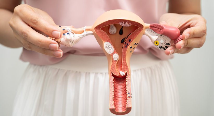 Gynäkologische Operationen - Dr. Nilouparak Hachemian - Frauenärztin Wien 1190