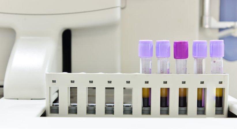 ACP-Therapie - OA Dr. med. univ. Stefan Eipeldauer - Orthopäde Baden 2500