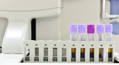 ACP-Therapie (Eigenblutbehandlung)