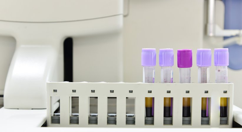 ACP-Therapie (Eigenblutbehandlung) - OA Priv. Doz. Dr. Florian Sevelda, Msc - Orthopäde Wien 1150