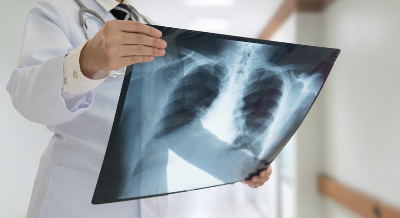 Besprechung von Röntgen und Thorax-CT-Befunden - Dr. Muhammad Jaddah - Lungenfacharzt Wien 1030