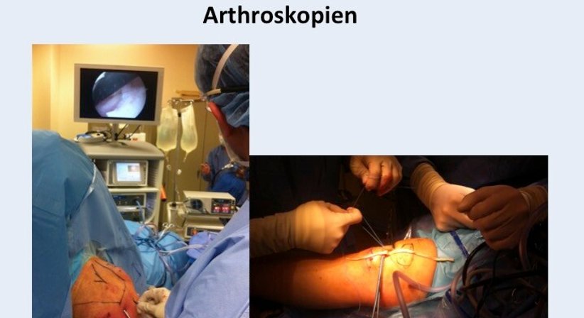 Arthroskopien - Prof. Dr. Dr. med. Patrick Sadoghi - Orthopäde Graz 8010
