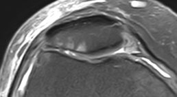 OA Dr. Rupert Schuster - Orthopäde Wien 1070