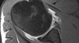 OA Dr. Rupert Schuster - Orthopäde Wien 1070