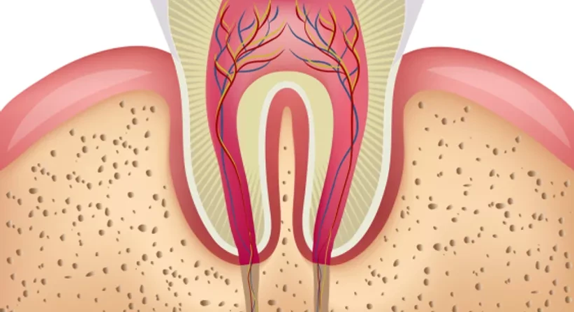 Wurzelbehandlung - Dr. med. dent. Lucas Merhaut - Zahnarzt Wien 1010