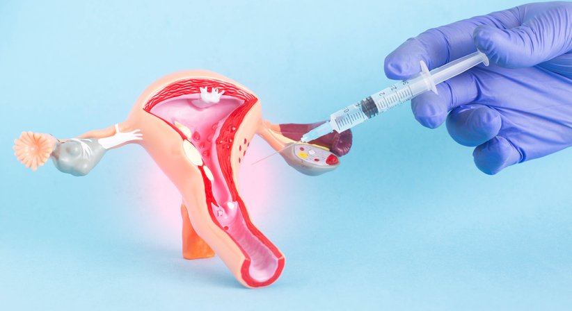 Schamlippenkorrektur - Doz. Dr. Georg Huemer - Plastischer Chirurg Wels 4600