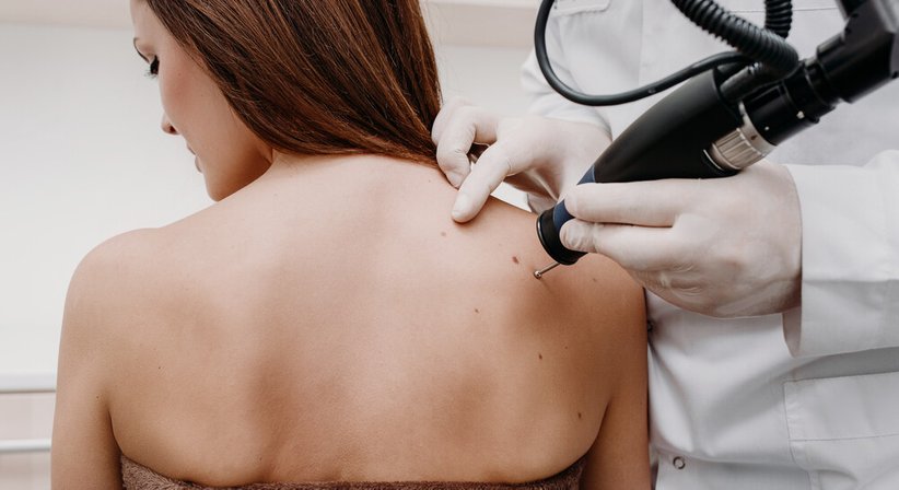 Hautkrebsbehandlung (Hautkrebs-Chirurgie)  - Dr. Spiro Silvester Schuller - Hautarzt Amstetten 3300