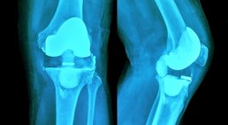 Prof. Dr. Klaus Schatz - Orthopäde Wien 1190