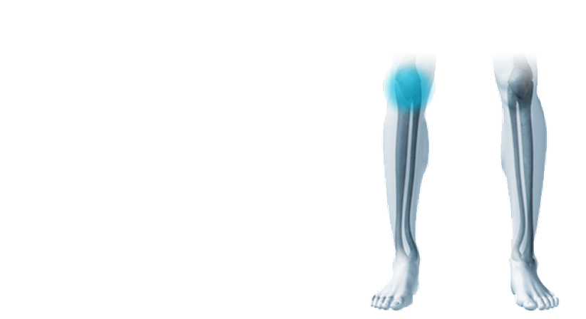 Meniskusriss - Prof. Dr. Klaus Schatz - Orthopäde Wien 1190