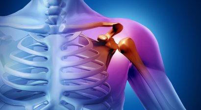 Schulterarthrose, Schulterprothese