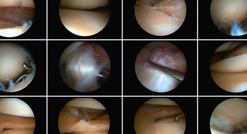 Arthroskopie - Dr. Bahram Mossawat - Orthopäde Wien 1010