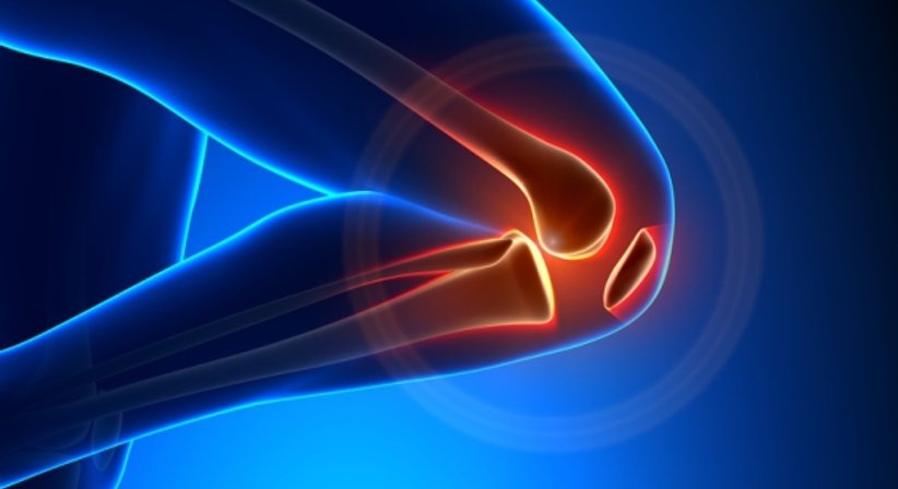 Kniescheibenverrenkung - Dr. Bahram Mossawat - Orthopäde Wien 1010