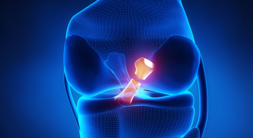 Kreuzbandriss - Dr. Bahram Mossawat - Orthopäde Wien 1010