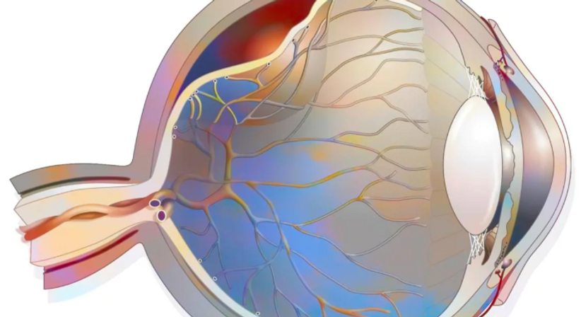 Laserchirurgie der Netzhaut - OA Dr. med. univ. Reza Fazeli - Augenarzt Wien 1220