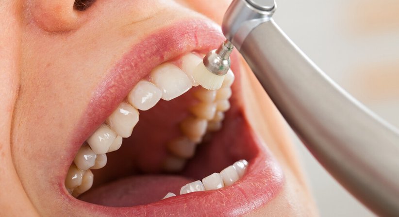 Prophylaxe / Professionelle Mundhygiene und Lasertherapie - Dr. Dr. med. univ. Johannes Küfler - Zahnarzt Illmitz 7142