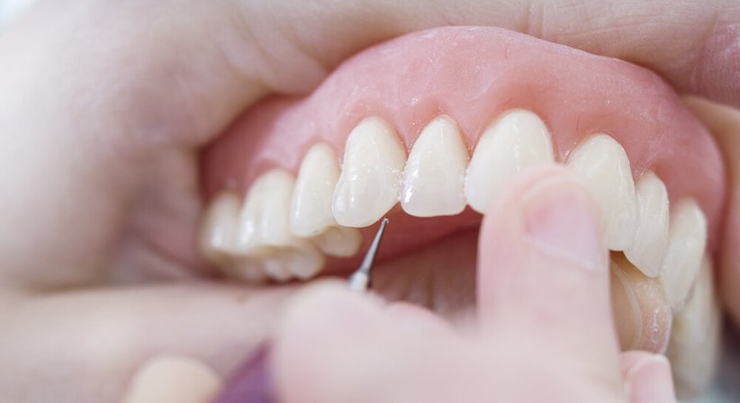 Prothetik - Dr. Dr. med. univ. Johannes Küfler - Zahnarzt Illmitz 7142