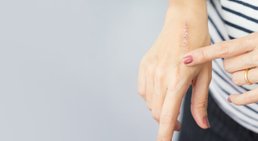 Dr. med. Eva Narro-Bartenstein - Hautärztin 8010 Graz