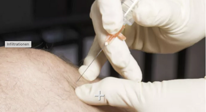 Infiltrationen/Infusionen