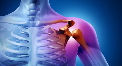 Schulterluxation / Schulterinstabilität