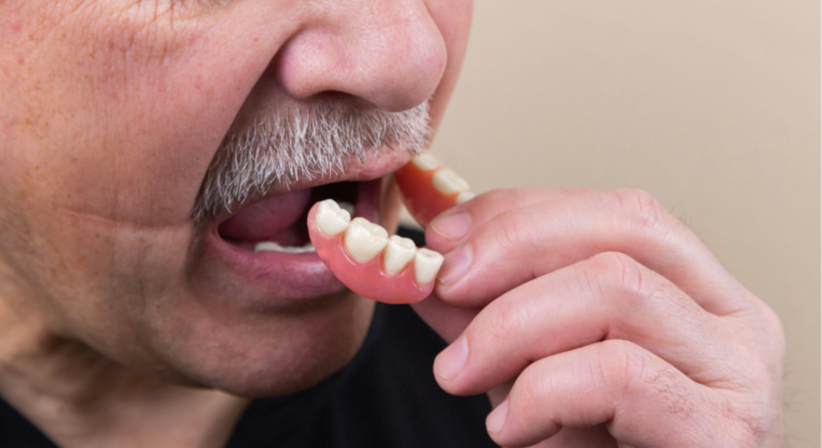 Prothetik / Zahnersatz - Dr. Sarah Abdel-Hamied - Zahnärztin Wien 1050