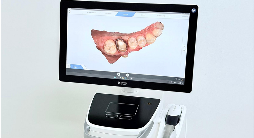 Digitaler 3D-Oralscanner (Abdruckfreie Behandlung) - Dr. Sarah Abdel-Hamied - Zahnärztin Wien 1050
