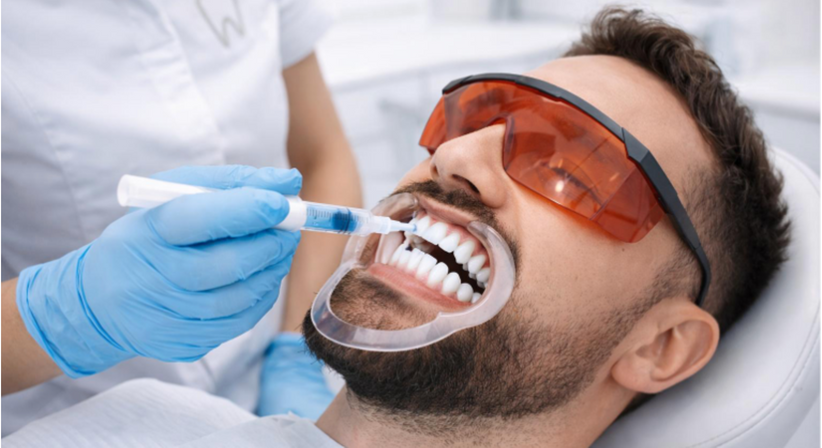 Bleaching - Dr. Sarah Abdel-Hamied - Zahnärztin Wien 1050