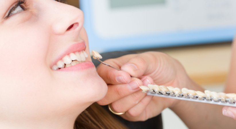 Ästhetische Zahnheilkunde - Dr. Claudia Kloodt, MSc. - Zahnärztin Wien 1090