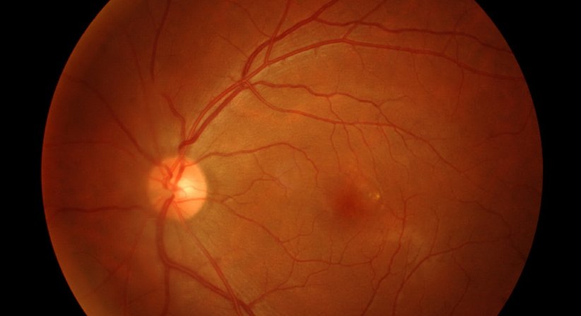 Optische Kohärenztomographie (OCT) - Dr. Clemens Bernhart - Augenarzt Wien 1010