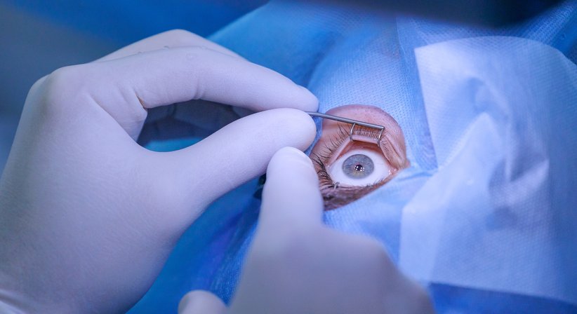 Netzhaut-Chirurgie - Dr. Clemens Bernhart - Augenarzt Wien 1010