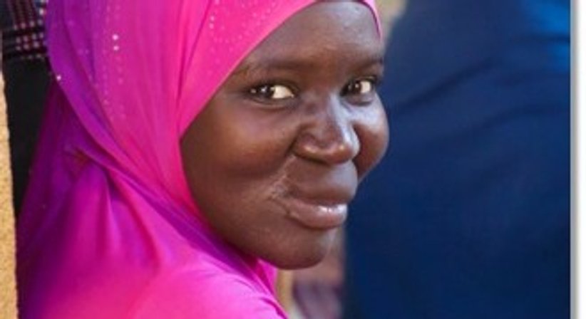 NOMA – Wiederherstellung von Kindergesichtern in Westafrika - Dr. Harald Kubiena - Plastischer Chirurg Wien 1190