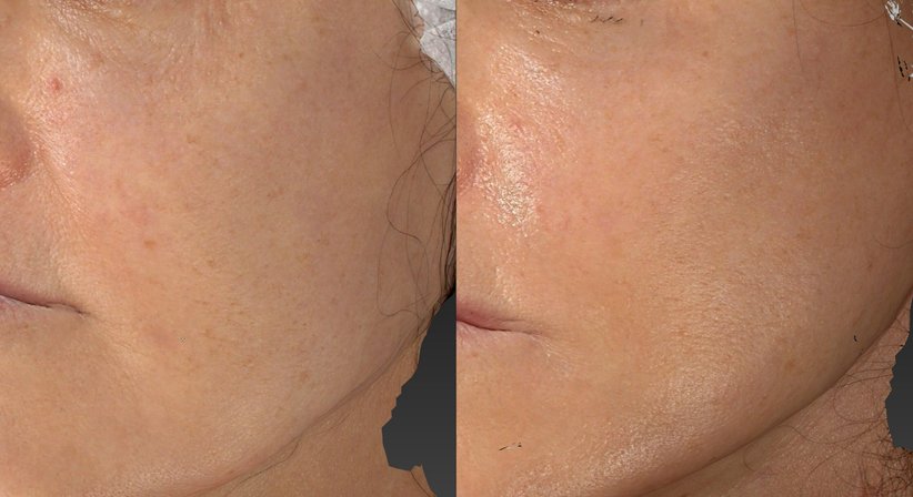 Ästhetisch-regenerative Gesichtsbehandlungen - Dr. Harald Kubiena - Plastischer Chirurg Wien 1190