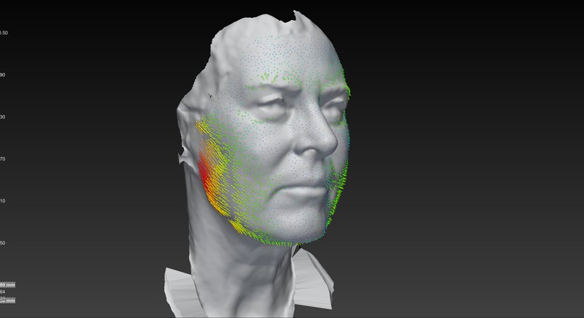 Ästhetische Gesichtschirurgie - Dr. Harald Kubiena - Plastischer Chirurg Wien 1190