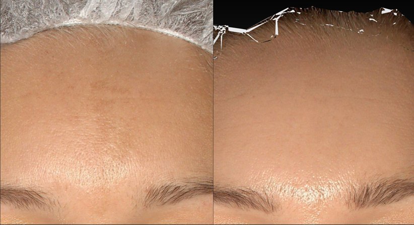 Ästhetisch-regenerative Gesichtsbehandlungen - Dr. Harald Kubiena - Plastischer Chirurg Wien 1190