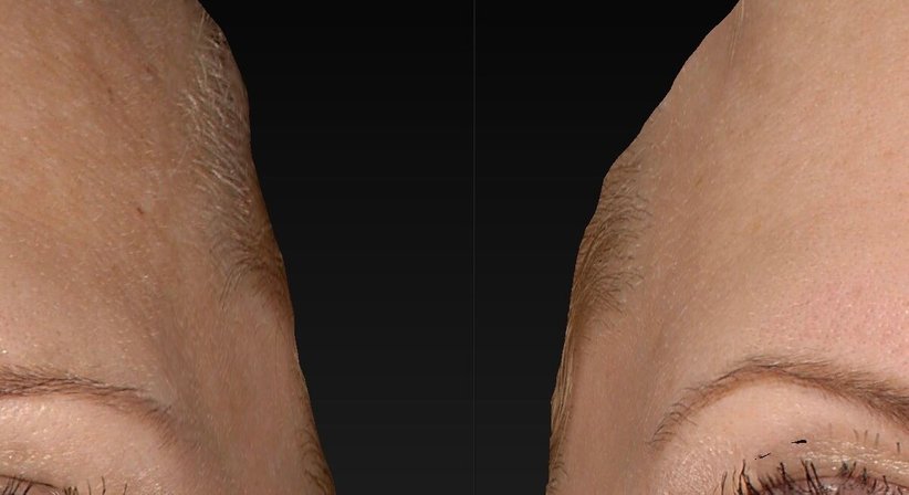 Ästhetisch-regenerative Gesichtsbehandlungen - Dr. Harald Kubiena - Plastischer Chirurg Wien 1190