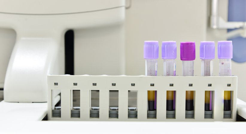 ACP-Therapie - Dr. Norbert Keiblinger - Unfallchirurg Gmunden 4810